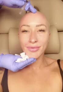 Cosmetic professional applying PRP during a microneedling facial at Third Eye Beauty Lounge in Tempe.
