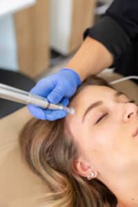 Microneedling at Third Eye Beauty Lounge in Tempe AZ