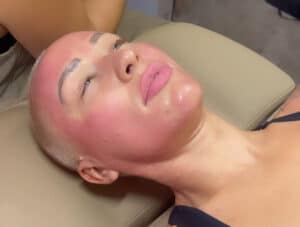 Microneedling at third eye beauty lounge in tempe az
