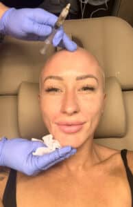 PRP injections by Katrina at Third Eye Beauty Lounge in Tempe, AZ