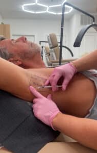 Katrina administering professional hyperhidrosis injections for excessive sweating at Third Eye Beauty Lounge