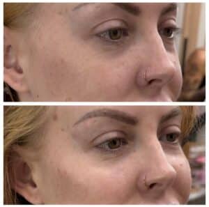 Before and after cheek filler results by Cosmetic Injector Katrina at Third Eye Beauty Lounge in Tempe, AZ. Showing natural lift, enhanced cheek definition, and improved facial symmetry with subtle, balanced volume