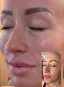 Before and after results of natural facial balancing by Katrina at Third Eye Beauty Lounge in Tempe, AZ — showing smoother skin, enhanced symmetry, and refreshed features with subtle injectable results.